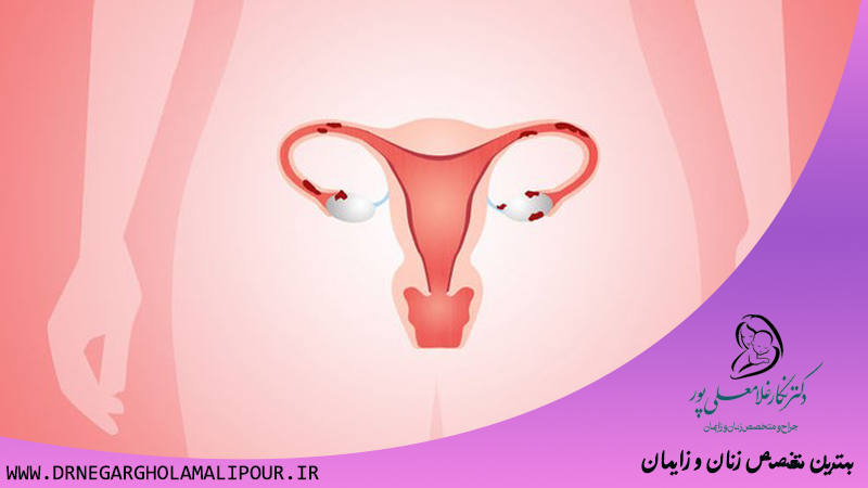 دکتر نگار غلامعلی پور | بهترین متخصص زنان و زایمان رشت | بهترین متخصص زنان،زایمان و نازایی رشت 