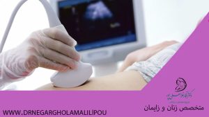 سونوگرافی NT