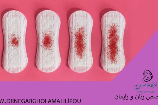 لکه بینی در بارداری
