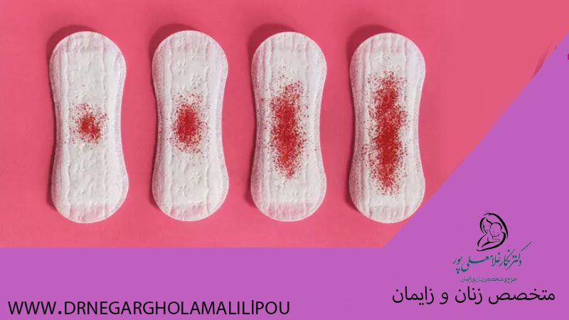 لکه بینی در بارداری
