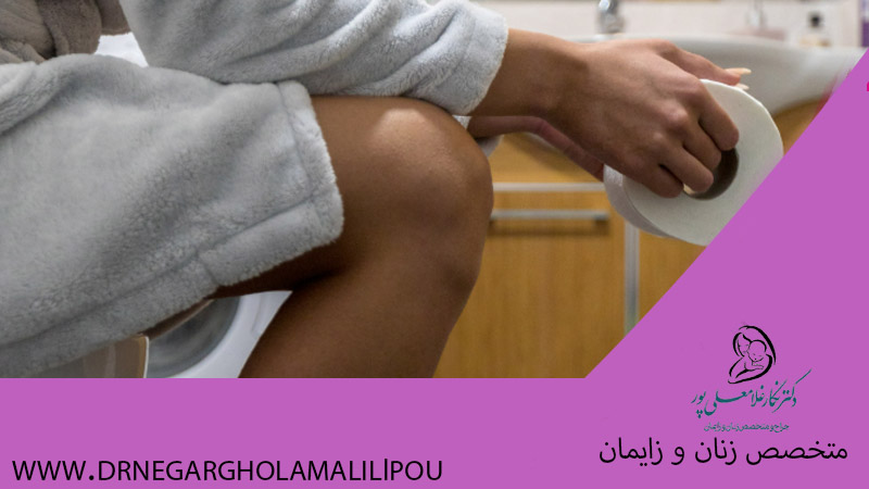 هموروئید بعد از زایمان طبیعی