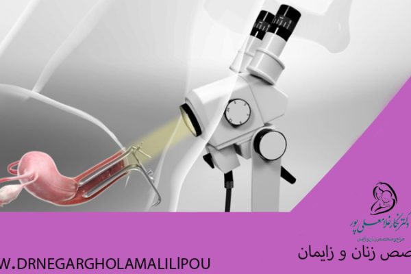 کولپوسکوپی چیست؟