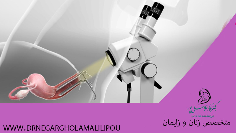 کولپوسکوپی چیست؟